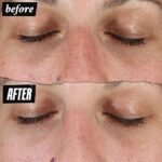 Kiehl's Clearly Corrective Dark Spot Serum, Paraben-free, Mineral Oil-free - Image 8